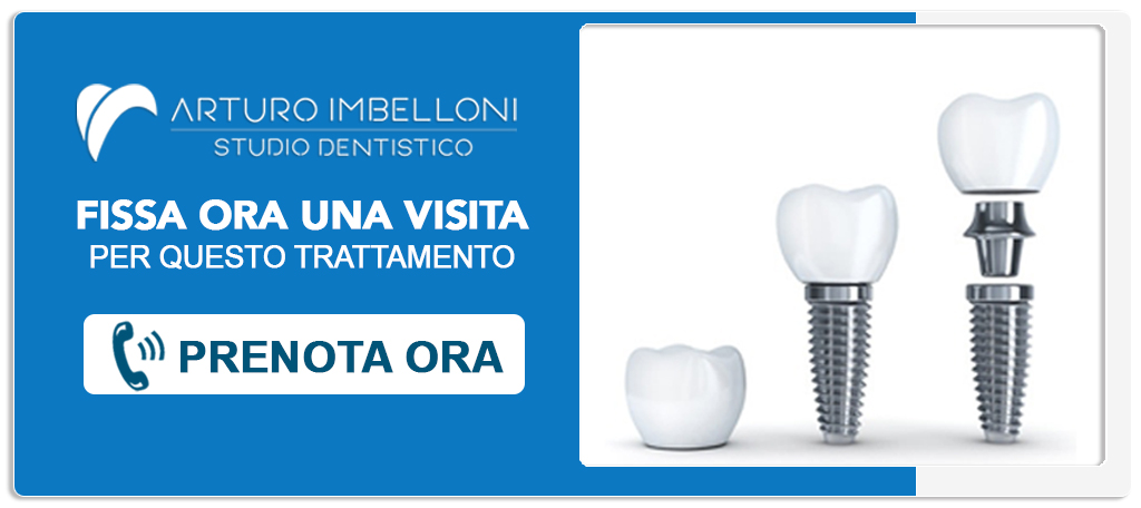 implantologia-poco-osso Roma (Prati)