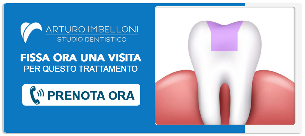 intarsio-dentale Roma (Prati)