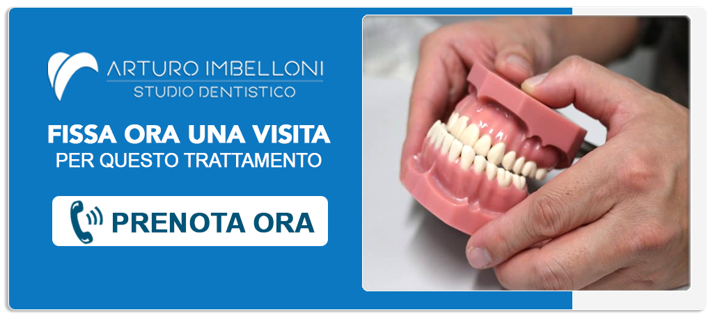 malocclusioni-dentali Roma (Prati)