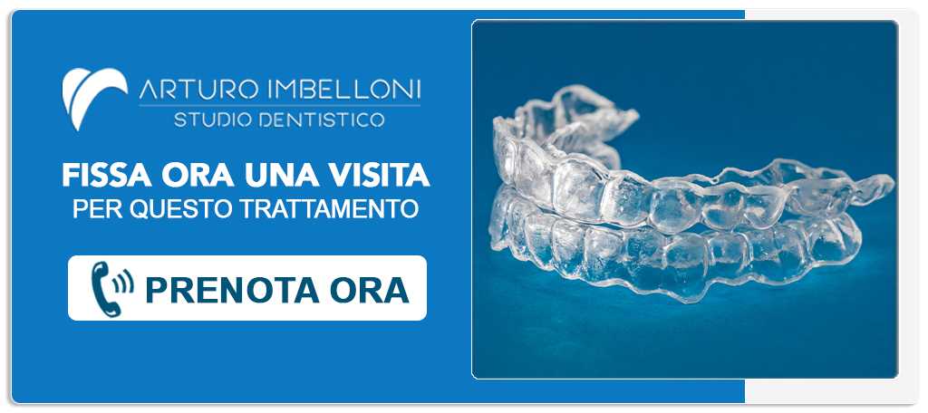 ortodonzia-invisalign Roma (Prati)