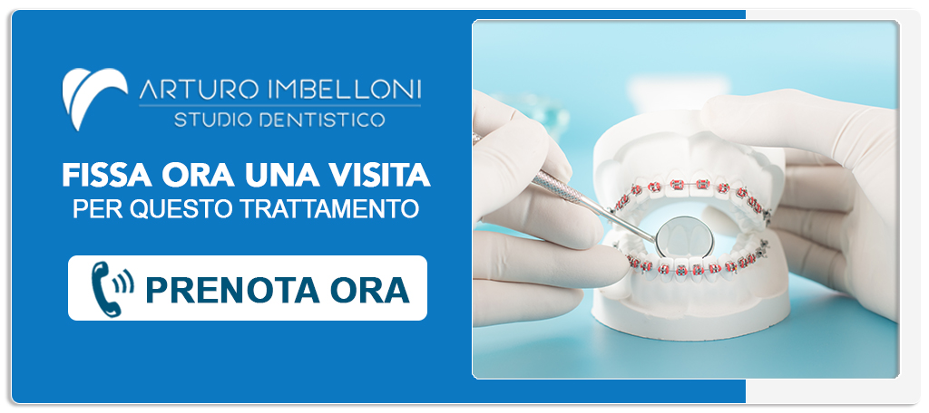 ortodonzia-prechirurgica Roma (Prati)